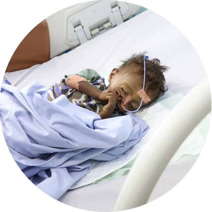 Přispějte na boj s podvýživou